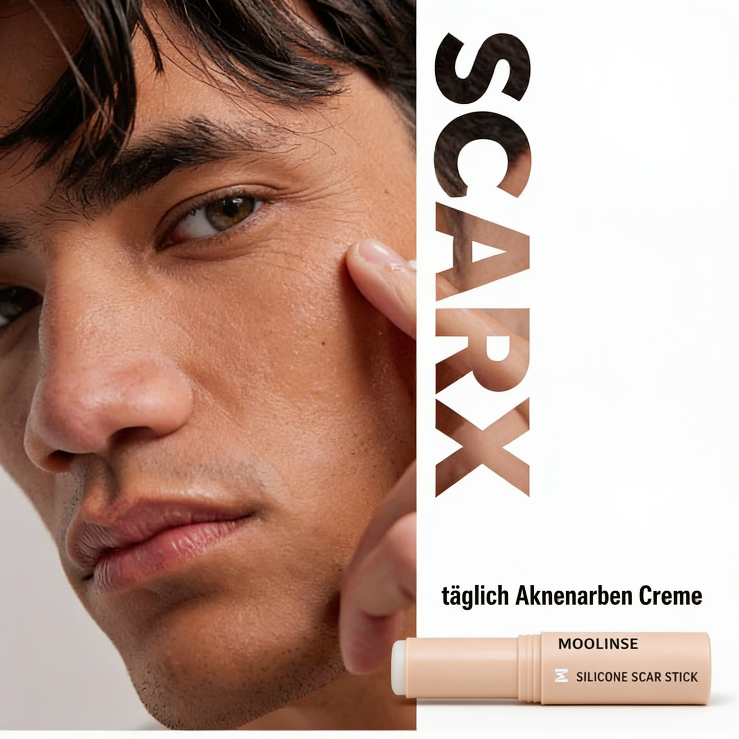 SCARX - Acne Scar Stick No. 01